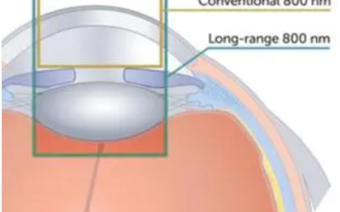 OCT光谱仪Cobra-S实现超深远距离成像