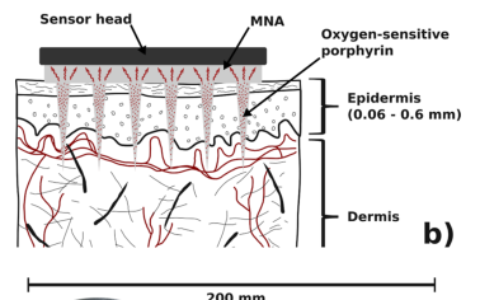 可以克服皮肤屏障功能的氧敏磷光微针阵列