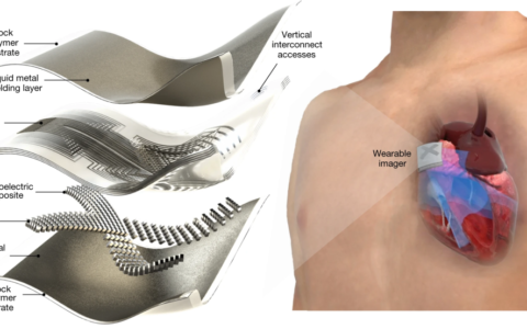 可穿戴超声贴检测实时心脏成像