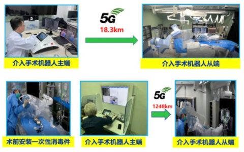 中科院自动化所自主研发的新一代微创血管介入手术机器人VasCure完成多例临床试验