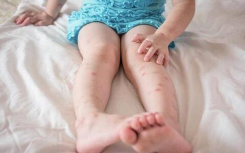 世界上最恶心的汉堡，用50万只蚊子做成的肉饼，你敢吃吗？-最奇葩的汉堡