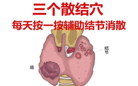 原创
常按三个穴位，行气祛湿化瘀，清除一切“淤堵”，消散全身结节(祛湿气最好的方法目前最有效的)