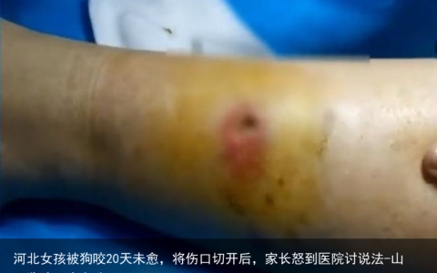 河北女孩被狗咬20天未愈，将伤口切开后，家长怒到医院讨说法-山西狗咬死小女孩