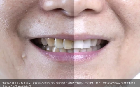 掉牙和寿命有关？60岁的人，牙齿剩多少颗才正常？看看你是否达标医生提醒：不论男女，腿上一旦出现这个标志，说明身体里有血栓-60几岁牙齿全部掉光了