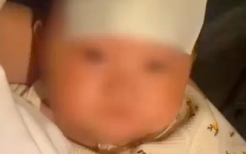 婴儿被轮番亲吻，高烧近40度！医生紧急提醒