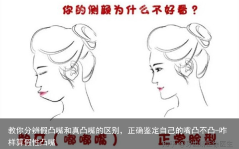 教你分辨假凸嘴和真凸嘴的区别，正确鉴定自己的嘴凸不凸-咋样算假性凸嘴