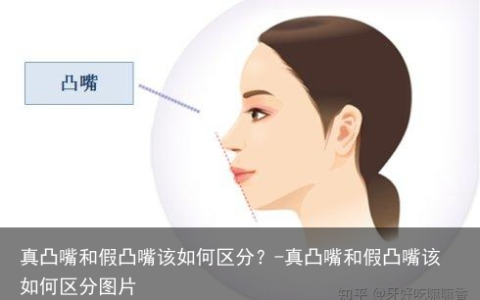 真凸嘴和假凸嘴该如何区分？-真凸嘴和假凸嘴该如何区分图片