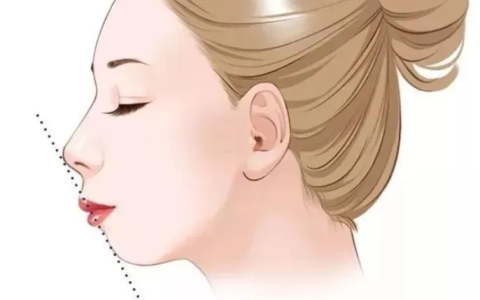 4种常见的凸嘴类型，看看你是哪一种？？？-“凸嘴”