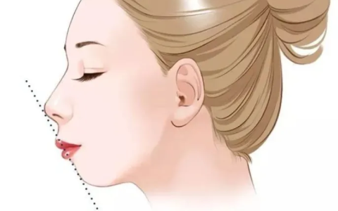 常见的4种凸嘴类型！看看你是哪一种？-凸嘴是由什么造成的