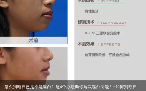 怎么判断自己是不是嘴凸？这4个办法助你解决嘴凸问题！-如何判断自己是否嘴凸