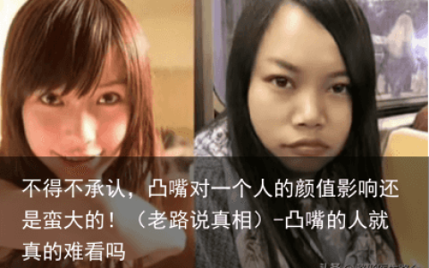 不得不承认，凸嘴对一个人的颜值影响还是蛮大的！（老路说真相）-凸嘴的人就真的难看吗