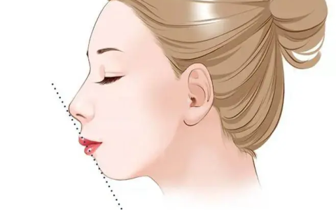 矫正前需明确真性突嘴与假性凸嘴-假性嘴凸怎么按摩改善