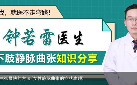 治疗女性静脉曲张最快的方法(女性静脉曲张的症状表现)