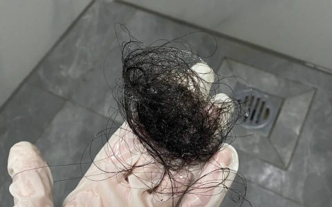 【深度爆料】那些我为治疗脱发做的事…真后悔没早知道这些方法！！(治疗脱发可信吗)