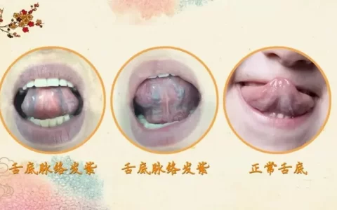 结节到底是什么？怎么消除？(身体上的结节是什么原因造成的)