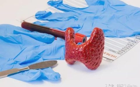 甲状腺结节怎么消除(甲状腺结节能消除掉吗)