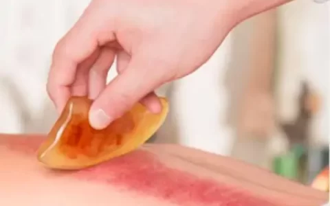 刮痧的五个简单方法 刮两肋疏肝解郁(怎么刮痧背部视频教程)