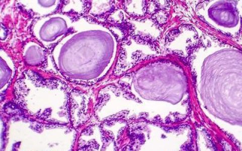 临汾最好的男科医院：得了睾丸炎会引起不育吗(临汾正规的男科医院在哪里)