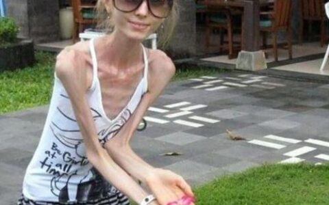 疯狂减肥危害大！人的标准体重是多少？医生教你计算方法(减肥的速度多少合适)