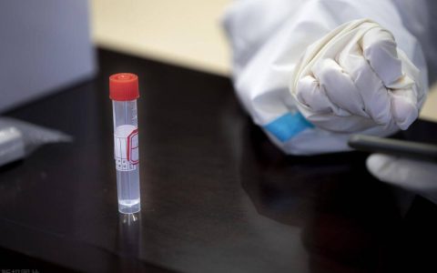 单管核酸检测多久出结果？单管测试一直不出结果会是阳性吗？-单管核酸检测多长时间出结果