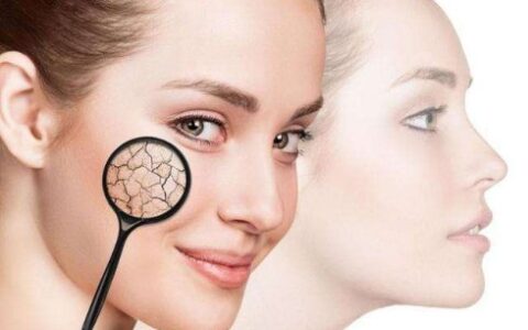 皮癣的种类与辨别图片-牛皮肤癣论坛