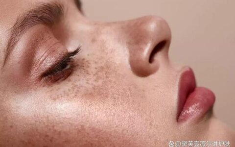 青春期脸上长斑怎么办？学生党应该如何调理-青春期脸上长黑点点是什么原因