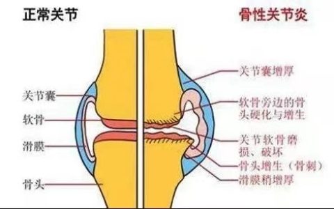 了解氨糖的功效与作用，健康养护关节-氨糖有什么功效和作用及副作用