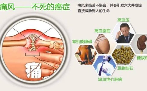 这两个清热利湿的方子合用让痛风害怕，痛风患者请收藏
