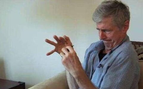 帕金森来袭，身体或会出现4种情况，别当成小毛病，需提高警惕-帕金森会有什么表现