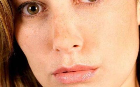 脸上长斑？应该怎么做才有效呢？这些要做好-脸上长斑小妙招