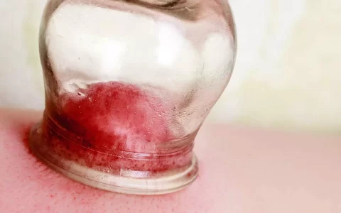 体内湿气重，会对身体造成这6个影响，需及时祛除湿气