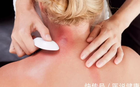 这两个习惯或导致体内湿气重，建议做好这2件事，或能祛除湿气黄老师为何会爆火？肤白貌美颜值高，看到她的素颜照后，我沉默了-体内湿气重怎么引起的原因