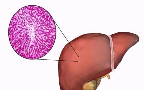 肝脏病变前或有这4个表现，医生建议：若占两个，可以检查看看-肝脏病变的早期症状有哪些