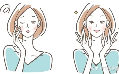 脸上长斑如何去除？-脸上的斑越来越多是什么原因引起的18岁