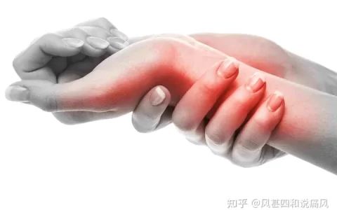 一分钟自测：3个方法测试痛风-自己如何测试