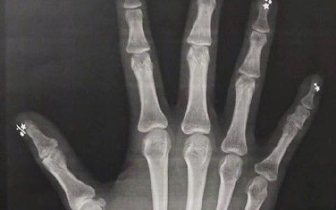 上百款美甲图，你喜欢的样式这里都有！-美甲图展示