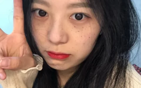 脸上长斑怎么办？-脸部长斑怎么内调