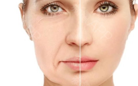 超声炮的危害和副作用、反容貌焦虑图鉴-超声炮的功效