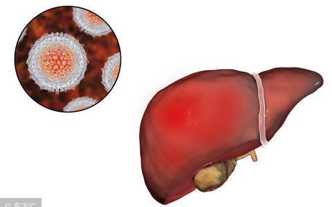 出现肝结节后，除了定期上医院检查，日常生活调理也很重要