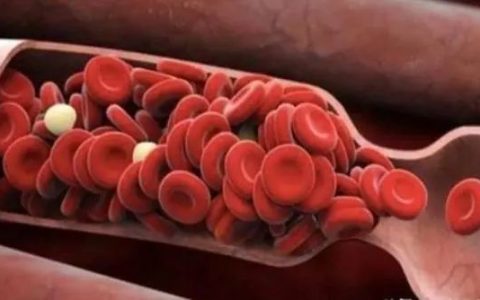 ​提醒：甘油三酯恢复到正常值，3物是降脂能手，没事多吃一吃