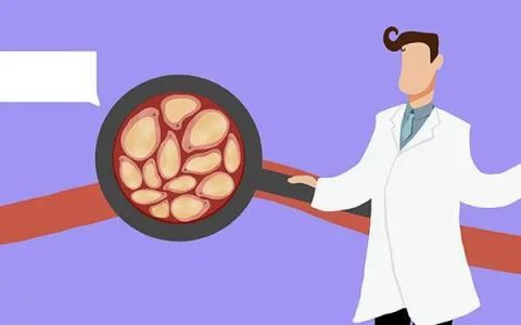 甘油三酯高的人，怎么做才能降脂？医生给出“降脂口诀”，要记住