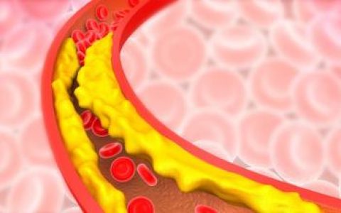 甘油三酯高的人有福了，每天吃一把这种东西，甘油三酯刷刷往下掉