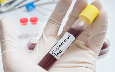 总是甘油三脂高，医生提醒：坚持“两少两多”，轻松降回正常值