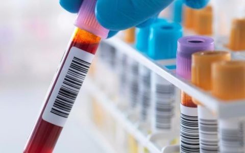 甘油三酯高了，怎么吃才能快速降下来？只知道不吃油就错了