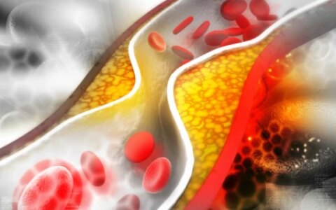 血脂高手麻，脚抽筋！这些降血脂食物每天换着吃，血管更健康！