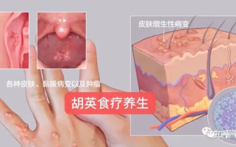 TCT报告怎么看？报告显示病变、可能是炎症！-tct检查结果怎么看报告图片