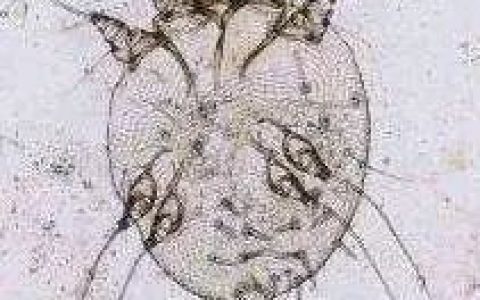 你知道疥疮是什么吗？-疥疮是什么引起的,什么症状