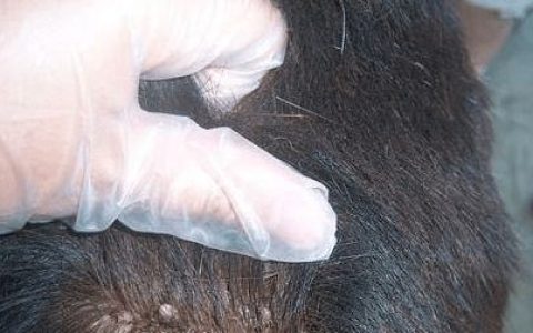 虱子是咋来的？30年前男女老少都长虱子，为何现在却“销声匿迹”-虱子的由来这是怎么长出来的