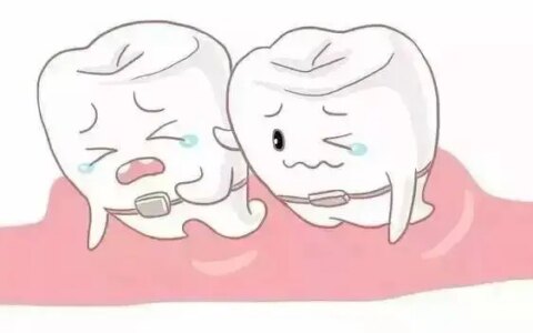 牙疼怎么止疼最快？这6个土办法能最快止疼！-牙疼怎么止疼最快百度知道