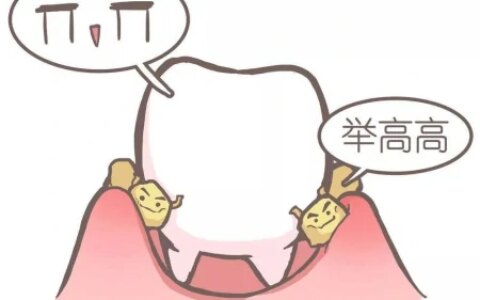 一篇关于洗牙的科普小文，看你知道多少洗牙的知识-洗牙的基本要点